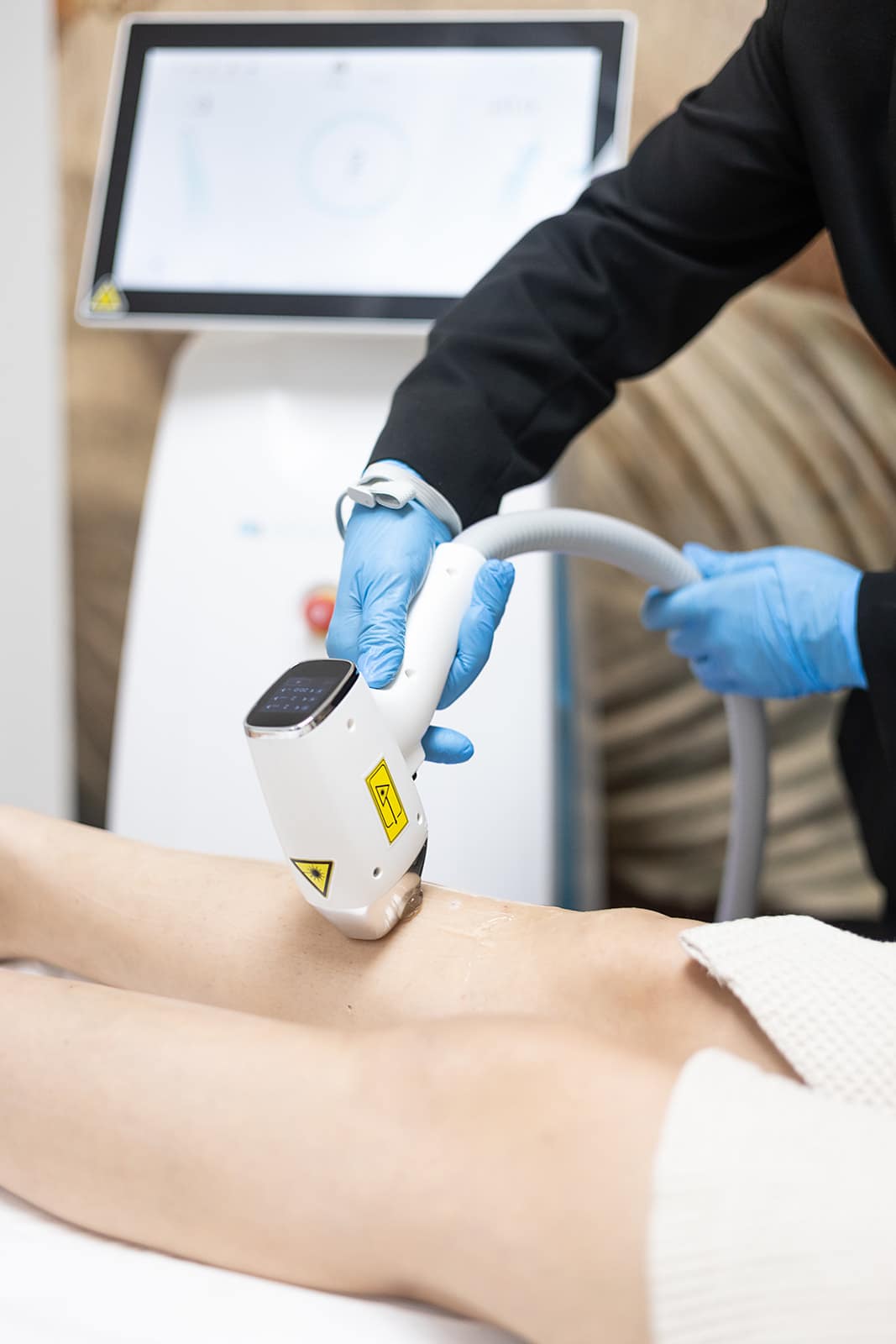 Laser Haarentfernung Wien